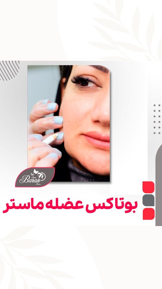 تزریق بوتاکس به عضله ماستر: بهبود فرم صورت و درمان دندان قروچه در خواب